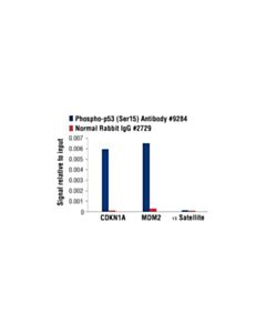 Cell Signaling Phospho-P53 (Ser15) Antibody