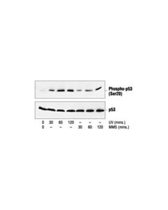 Cell Signaling Phospho-P53 (Ser20) Antibody