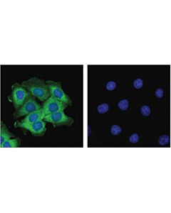 Cell Signaling Alix (E6p9b) Rabbit mAb