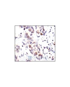 Cell Signaling Rb (4h1) Mouse mAb