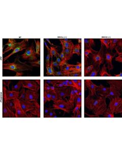 Cell Signaling Phospho-Gsk-3beta (Ser9) (5b3) Rabbit mAb