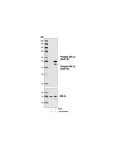 Cell Signaling Phospho-Gsk-3alpha/Beta (Ser21/9) (37f11) Rabbit mAb (Gsk-3alpha Preferred)