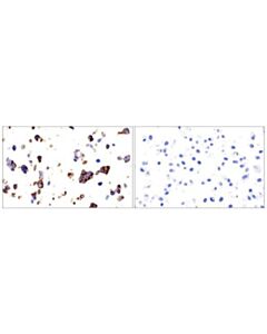Cell Signaling Ve-Cadherin (E6n7a) Rabbit mAb
