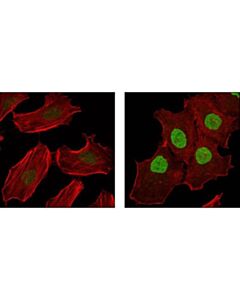 Cell Signaling Phospho-P90rsk (Thr573) Antibody