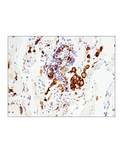 Cell Signaling Cd163 (D6u1j) Rabbit mAb
