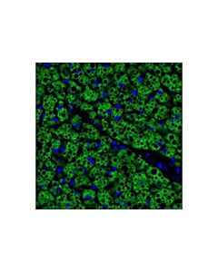 Cell Signaling Perilipin-1 (D1d8) Xp Rabbit mAb