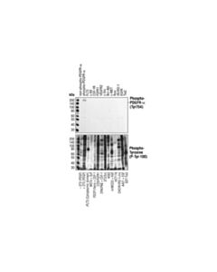 Cell Signaling Pdgf Receptor Alpha Antibody Sampler Kit