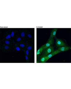 Cell Signaling Phospho-Stat6 (Tyr641) Antibody