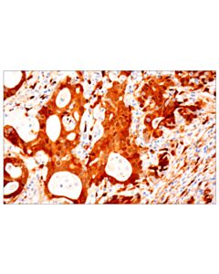 Cell Signaling Yap/Taz (E9m8g) Rabbit mAb
