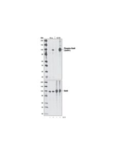 Cell Signaling Phospho-Stat6 (Tyr641) (C11A12) Rabbit mAb 20 uL