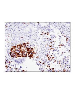 Cell Signaling Arginase-1 (D4e3m) Xp Rabbit mAb