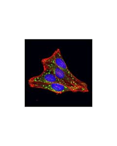 Cell Signaling Rab7 (D95f2) Xp Rabbit mAb