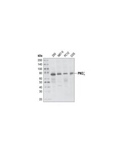 Cell Signaling Pkczeta (C24e6) Rabbit mAb