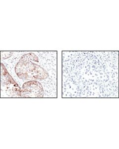 Cell Signaling Gsk-3 Antibody Sampler Kit