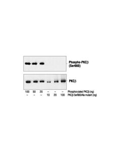 Cell Signaling Phospho-Pkc (Pan) (Betaii Ser660) Antibody