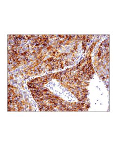 Cell Signaling Epcam (E6v8y) Xp Rabbit mAb (Mouse Preferred)