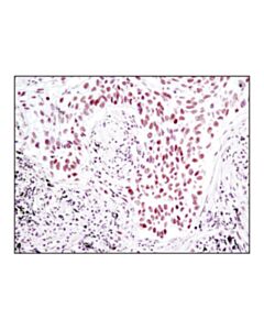 Cell Signaling Sp1 (D4c3) Rabbit mAb