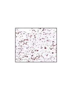 Cell Signaling Phospho-Threonine-Proline Mouse mAb (P-Thr-Pro-101)
