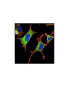Cell Signaling Crmp-2 Antibody