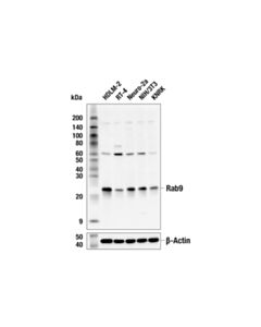 Cell Signaling Rab9A (E2I3T) Mouse mAb 20 uL