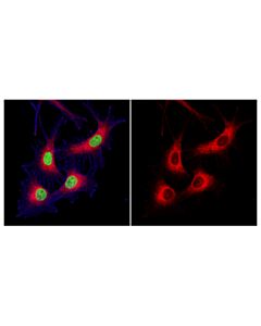 Cell Signaling Rab7 (D95f2) Xp Rabbit mAb (Alexa Fluor 647 Conjugate)