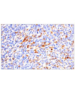 Cell Signaling CD22 (F9D1W) Rabbit mAb