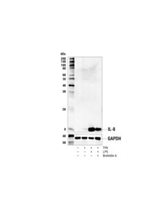 Cell Signaling Il-8 (E5f5q) Xp Rabbit mAb