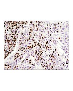 Cell Signaling Ki-67 (8d5) Mouse mAb
