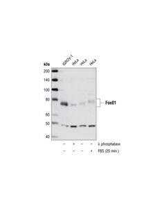 Cell Signaling Foxo1 (L27) Antibody