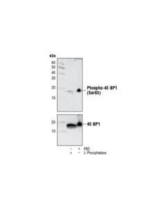 Cell Signaling Phospho-4E-BP1 (Ser65) (174A9) Rabbit mAb 20 uL