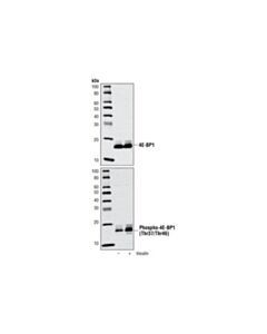 Cell Signaling Phospho-4e-Bp1 (Thr37/46) Antibody