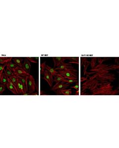 Cell Signaling Sirt1 (D1d7) Rabbit mAb