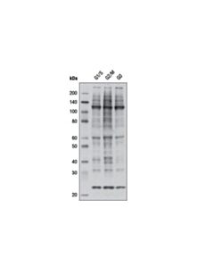 Cell Signaling Phospho-Cdk Substrate Motif [(K/H)Psp] Multimab Rabbit mAb Mix