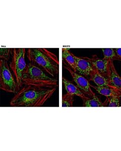Cell Signaling Mitofusin-2 (D2d10) Rabbit mAb