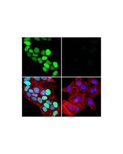Cell Signaling Wip1 (E2x1i) Rabbit mAb