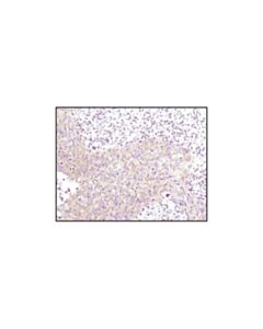 Cell Signaling Phosphoplus Glycogen Synthase (Ser641) Antibody Duet