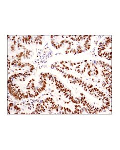 Cell Signaling Asymmetric Dimethyl-Smarcc1/Baf155 (Arg1064) (D8i3u) Rabbit mAb