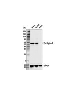 Cell Signaling Perilipin-2 (E6g6m) Rabbit mAb