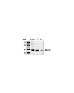 Cell Signaling Smad5 Antibody
