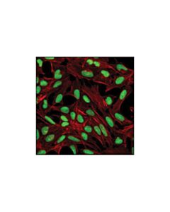 Cell Signaling Parp (46d11) Rabbit mAb