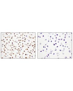 Cell Signaling Stk33 (D3s4r) Rabbit mAb