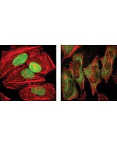 Cell Signaling Pdcd4 (D29c6) Xp Rabbit mAb