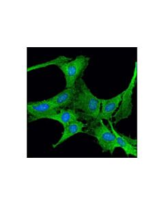 Cell Signaling Ribosomal Protein S3 (D50g7) Xp Rabbit mAb