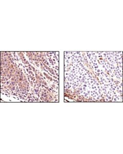 Cell Signaling Pten (138g6) Rabbit mAb