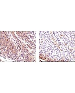 Cell Signaling Pten (138g6) Rabbit mAb