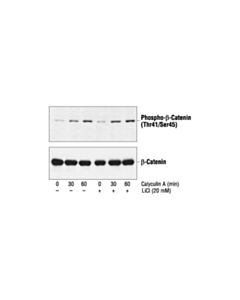 Cell Signaling Phospho-Beta-Catenin (Thr41/Ser45) Antibody
