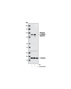 Cell Signaling Phospho-Beta-Catenin (Ser675) Antibody