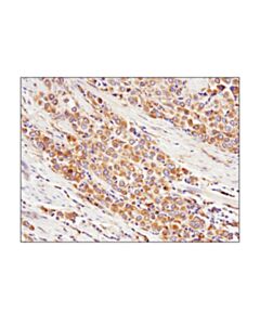 Cell Signaling Rab7 (E9o7e) Mouse mAb