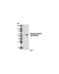 Cell Signaling Phospho-Smad1/5 (Ser463/465) (41d10) Rabbit mAb (Biotinylated)