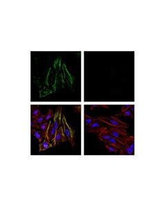 Cell Signaling Phospho-Myosin Light Chain 2 (Thr18/Ser19) (E2j8f) Rabbit mAb